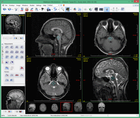 dicom,pacs,hl7,his,ris,makhaon,medic,medical,image,visualisation,information,software,dimse,dul,communication,mri,us,gamma,imagi