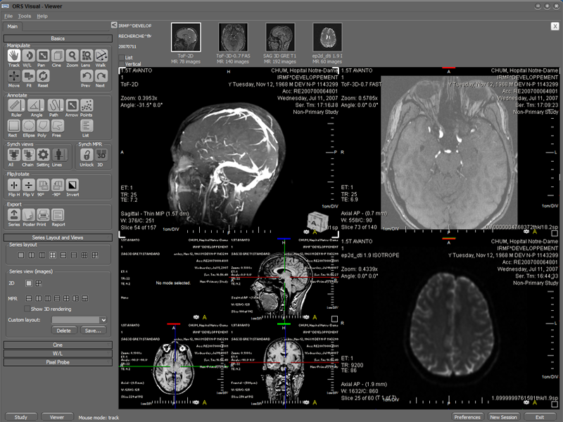 dicom viewer, medical image viewer, pacs viewer, dicom